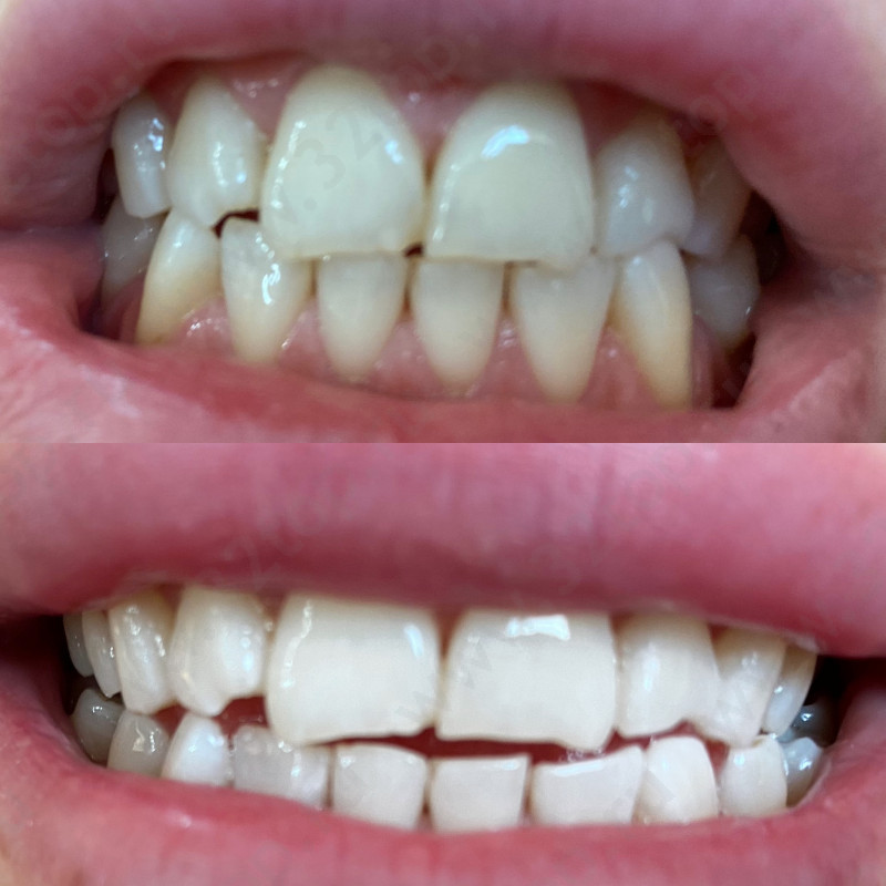 Студия по отбеливанию зубов WHITE&SMILE (УАЙТ ЭНД СМАЙЛ)
