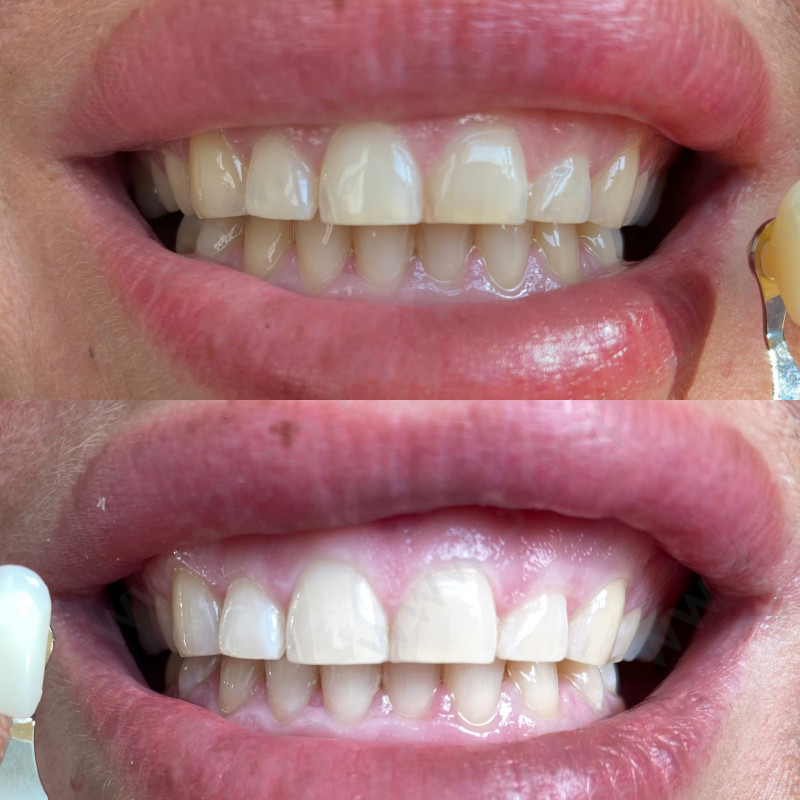 Студия по отбеливанию зубов WHITE&SMILE (УАЙТ ЭНД СМАЙЛ)